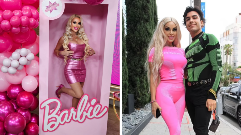 Who is Marcela Iglesias? 'Human barbie' to undergo blood transfusion from son to stay young