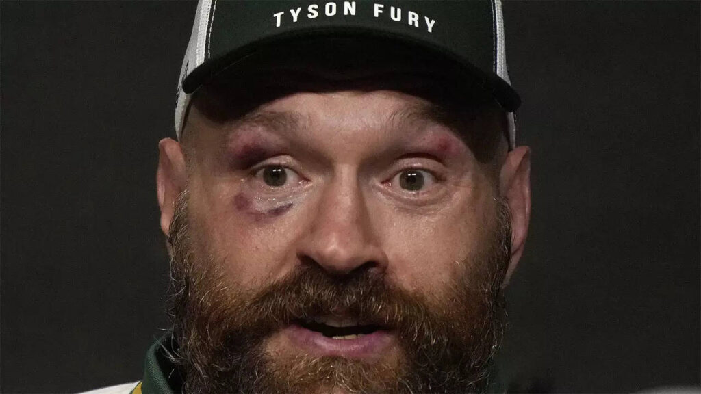 Tyson Fury announces retirement from boxing, again