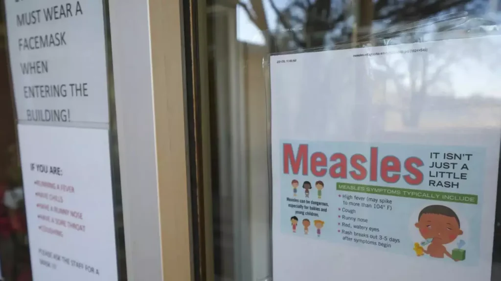 Texas child dies from measles, marking first US fatality in a decade