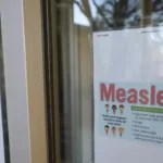 Texas child dies from measles, marking first US fatality in a decade